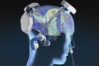 파킨슨병 의료기기에는 어떤 레이저 모듈이 사용됩니까?